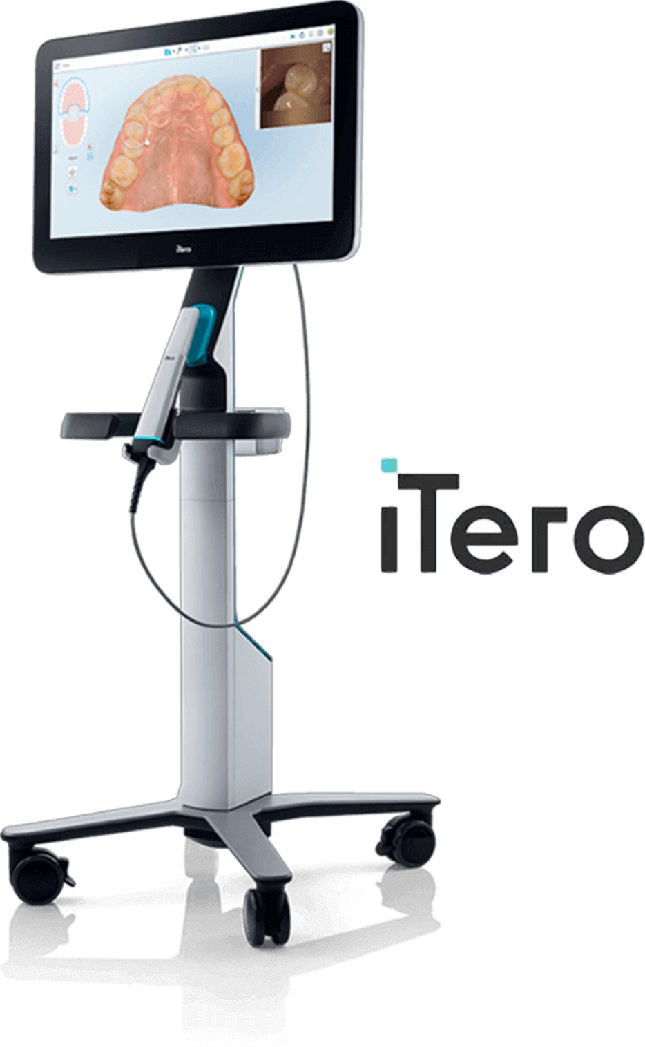 歯の形、歯ぐき、咬み合わせなど「表面構造」をスキャン 口腔内スキャナー