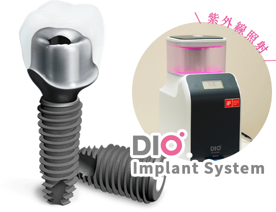 デジタル技術に特化 DIOインプラント
