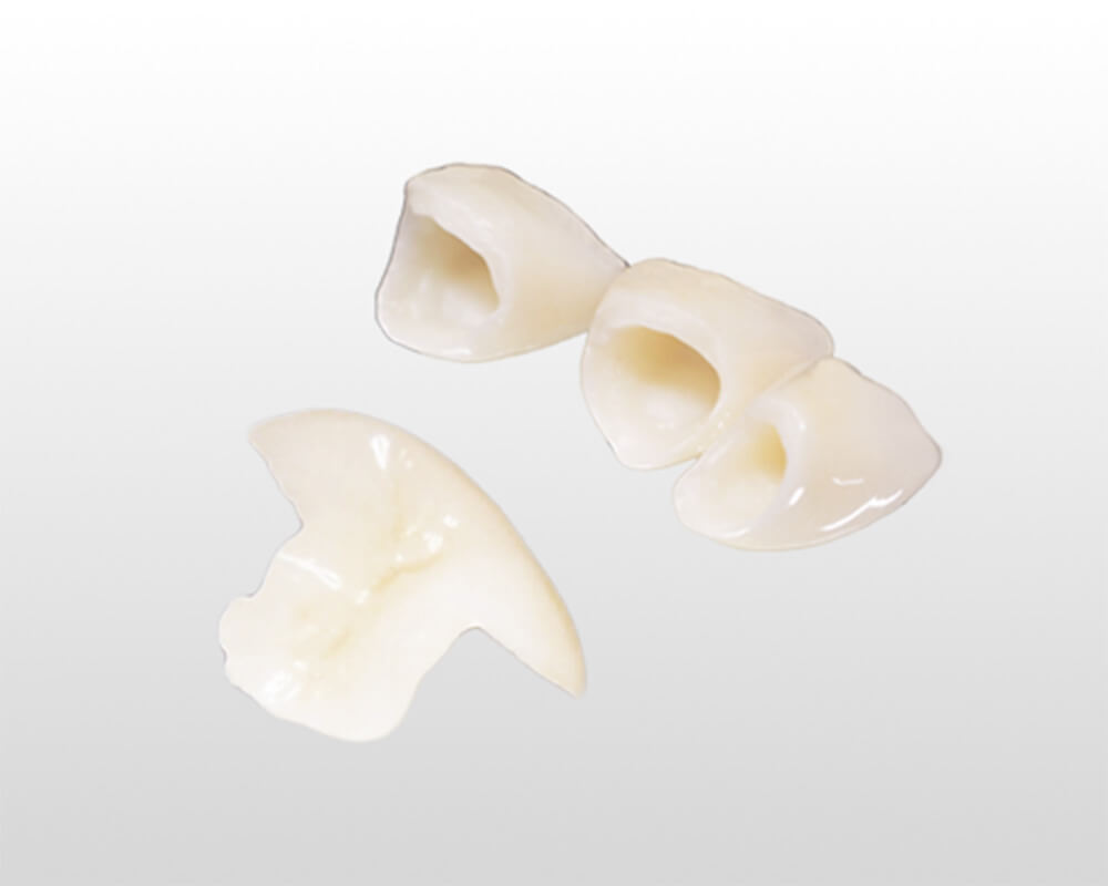 ブリッジ・かぶせ物がある方の疑問…