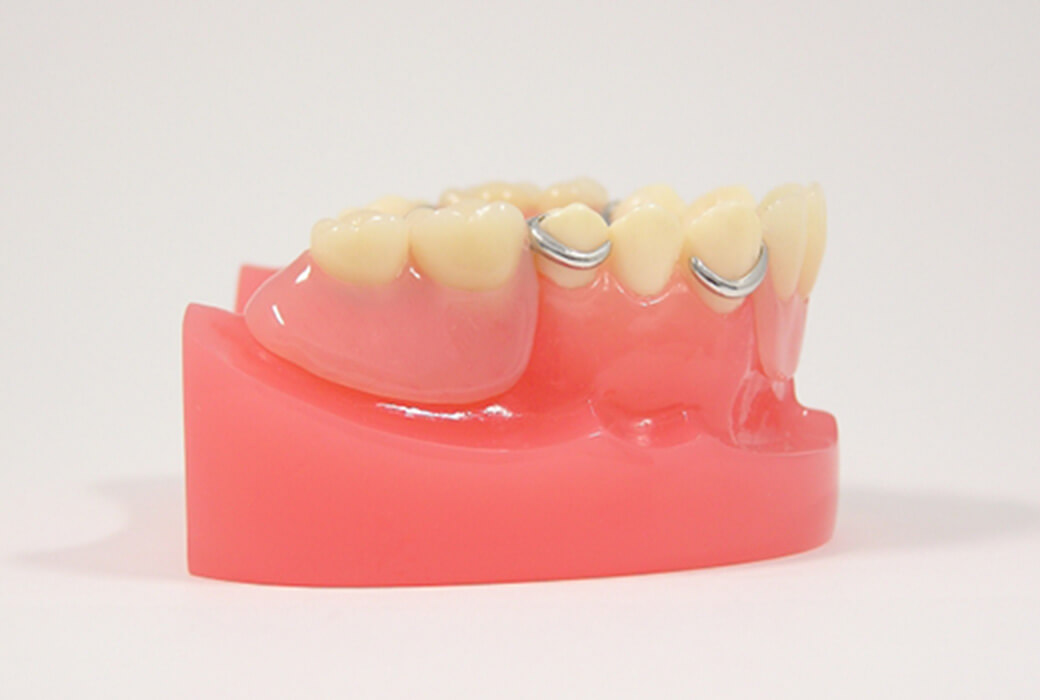 入れ歯が合わない方